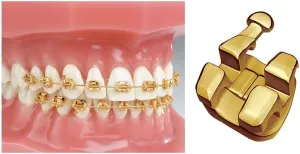 J&J Ortho Dorada Gold Plated Bracket MBT/Roth (Standard MBT 022 345H)